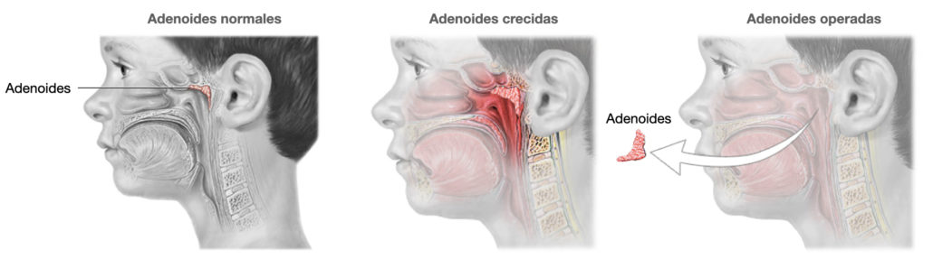 Otorrinolaringólogo en Guadalajara | Vocalia ® | Dr. Gerardo López Guerra, Otorrinolaringólogo │ Laringólogo | Cirugía de Laringe, Oídos, Nariz y Garganta.