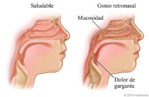Otorrinolaringólogo en Guadalajara | Vocalia ® | Dr. Gerardo López Guerra, Otorrinolaringólogo │ Laringólogo | Cirugía de Laringe, Oídos, Nariz y Garganta.