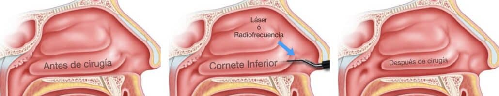 Otorrinolaringólogo en Guadalajara | Vocalia ® | Dr. Gerardo López Guerra, Otorrinolaringólogo │ Laringólogo | Cirugía de Laringe, Oídos, Nariz y Garganta.