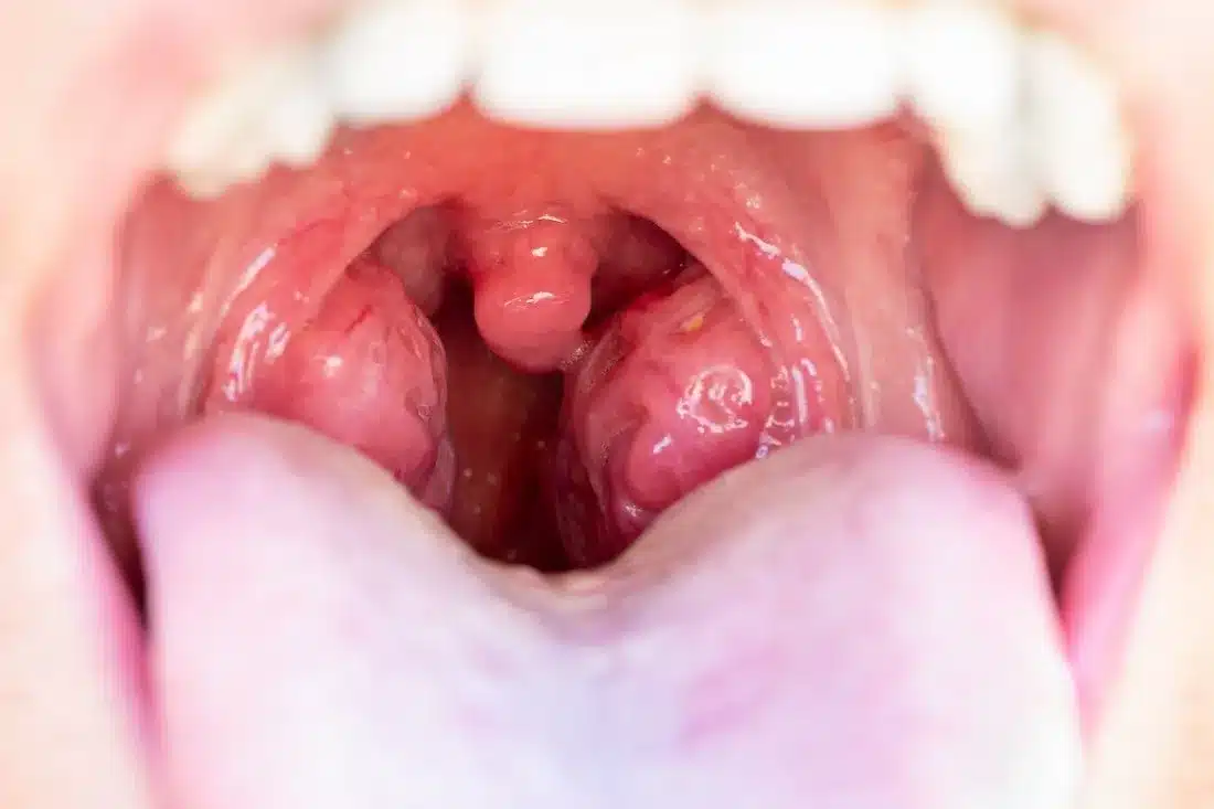Otorrinolaringólogo en Guadalajara | Vocalia ® | Dr. Gerardo López Guerra, Otorrinolaringólogo │ Laringólogo | Cirugía de Laringe, Oídos, Nariz y Garganta.